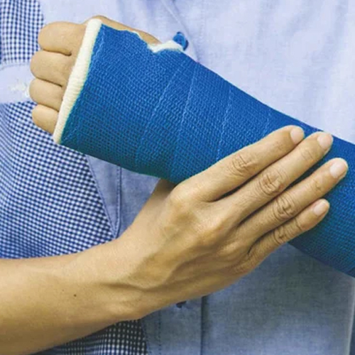 Synthetic-Cast-Tape-3